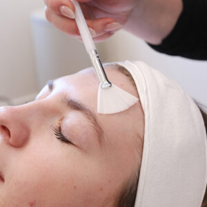 Glow Peel
