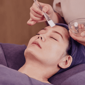 Melasma Peel
